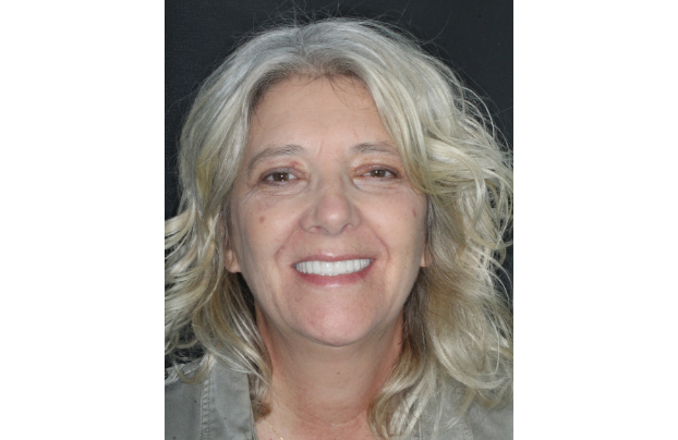 sourire-apres-soins-valerie