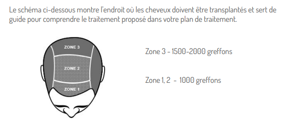 schema capillaire zones à greffer