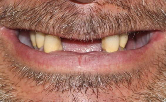 sourire Jérôme avant