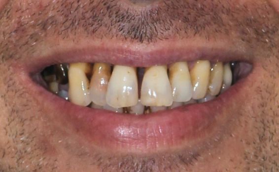 sourire Julien avant