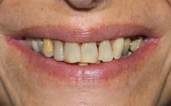 sourire Sophie avant