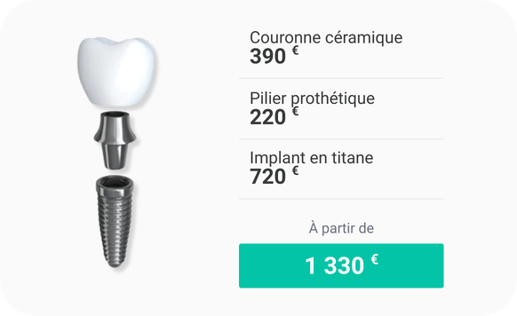 Prix d'un implant dentaire en Espagne