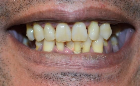 Abdelamid sourire avant