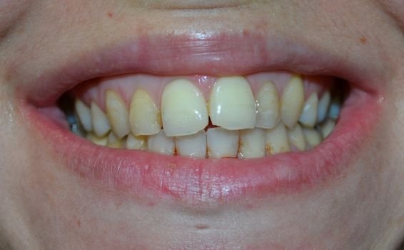 Delphine sourire avant