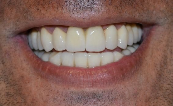 Michael sourire après