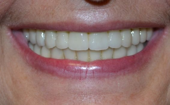 Yvette sourire après