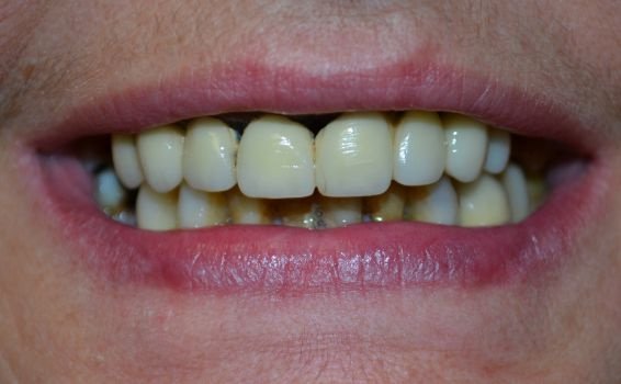 Yvette sourire avant