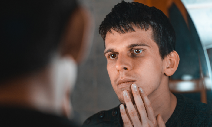homme imberbe qui songe à la greffe de cheveux