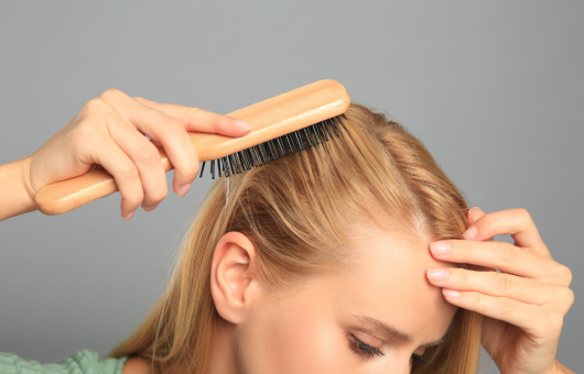 femme qui perd ces cheveux et pense à la greffe de cheveux