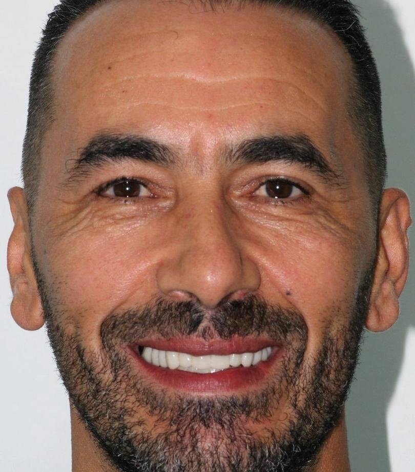 Maamar après ses soins dentaires