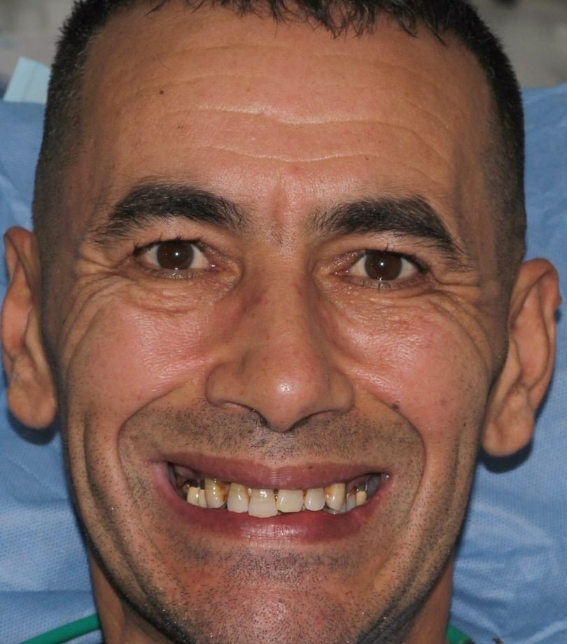 Maamar avant ses soins dentaires